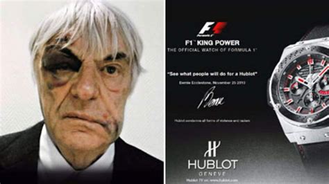 F1 Boss Bernie Turns Mugging To Ad.